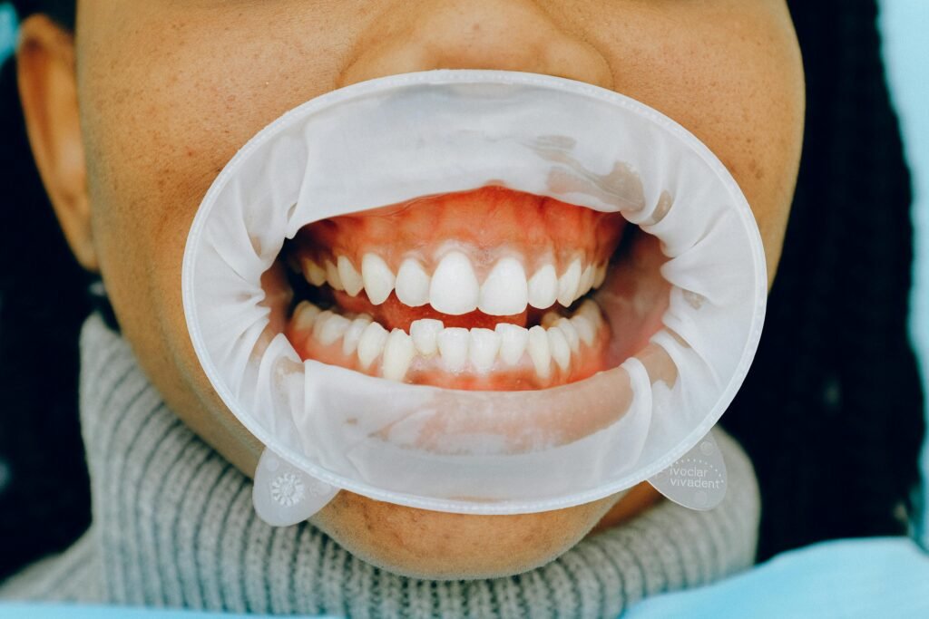Best Way to Reduce Gap Between Teeth Naturally at Home 2025